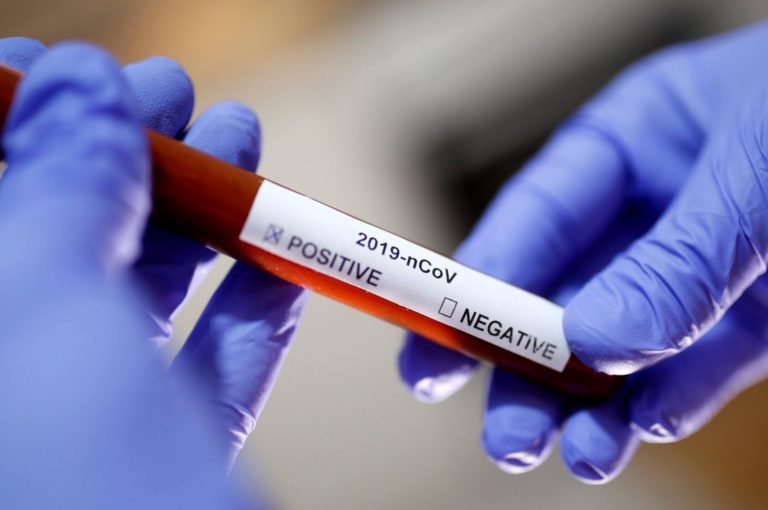 Live Update : Coronavirus की Rapid Testing शुरू करने वाला पहला राज्य बना राजस्थान