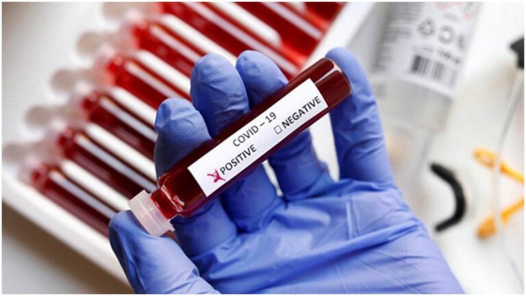 सुप्रीम कोर्ट ने RT-PCR Test का अधिकतम मूल्य तय करने की संबंधी याचिका पर केन्द्र से मांगा जवाब
